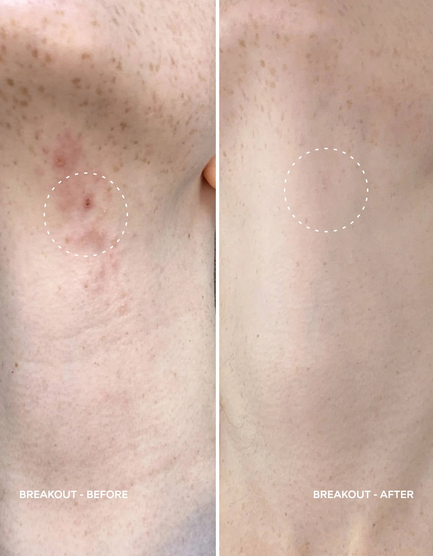 Magic Molecule Antimicrobial Skin Cleanser- MEGA Size