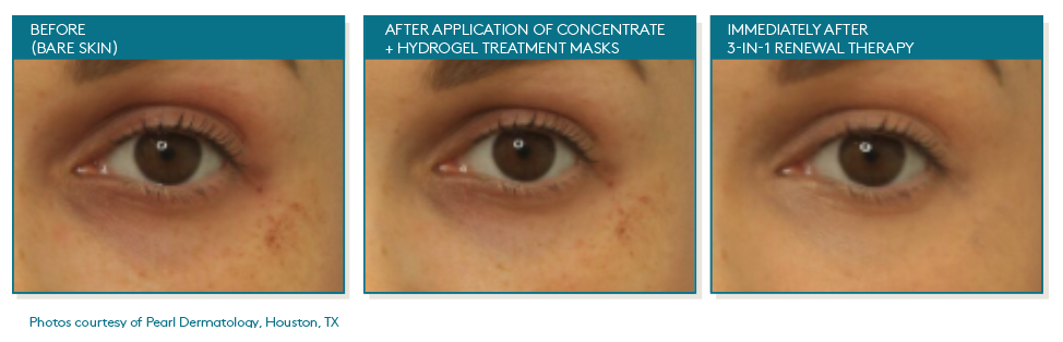 Total Eye Concentrate Rollerball