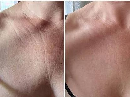 KrX Neck Lift Intensive Firming Cream